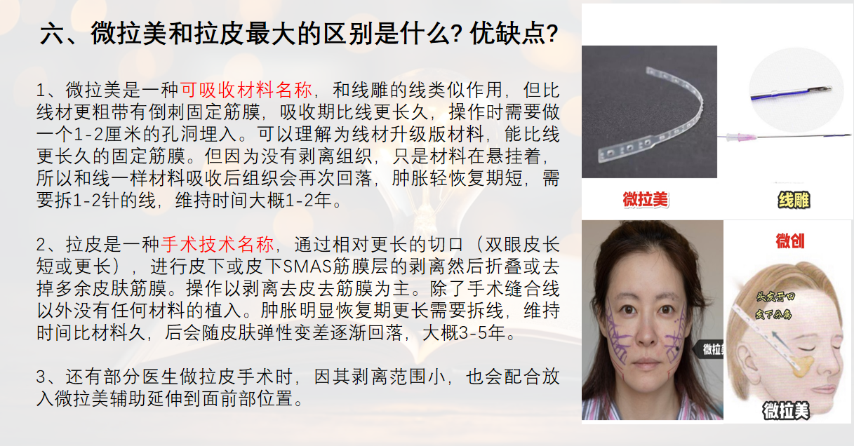 郭玉瑞面部提升價格表：輕度松弛1.2萬起/內(nèi)窺鏡提升3萬起收費明細看這