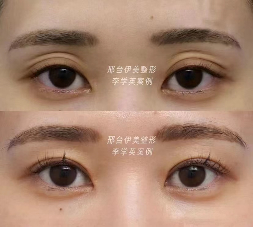 四川華 西醫(yī)院卿勇醫(yī)生的技術(shù)特點