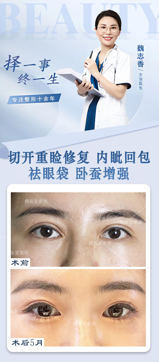 四川華 西醫(yī)院卿勇醫(yī)生的預(yù)約方式