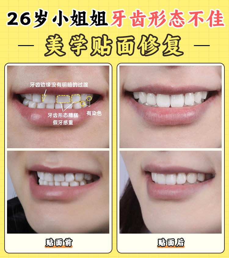 烏魯木齊好一點的牙科醫(yī)院有哪幾家？美奧口腔——國內(nèi)外連鎖高端局，品質(zhì)黨專屬私密體驗