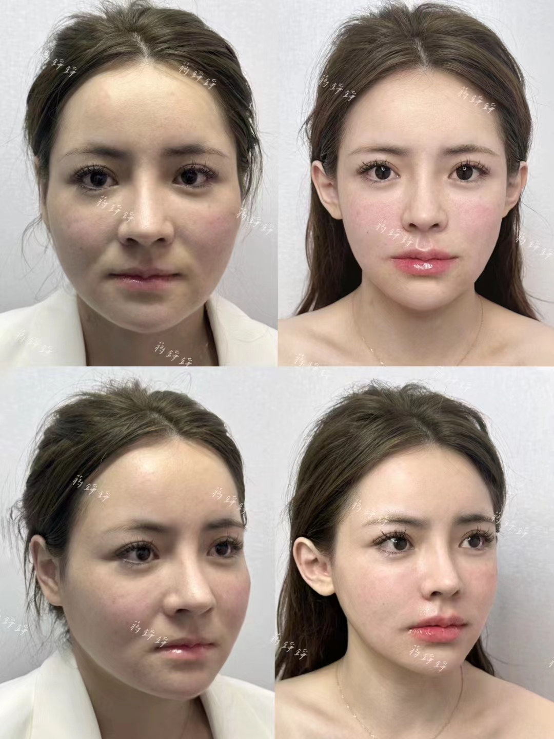 金洪堯個(gè)人簡歷揭秘：近20年脂肪領(lǐng)域經(jīng)驗(yàn)，擅長的核心項(xiàng)目