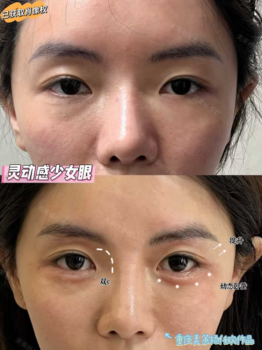 金洪堯醫(yī)生抽脂怎么樣？從業(yè)近20年，超聲乳化體雕技術(shù)創(chuàng)傷小恢復(fù)快