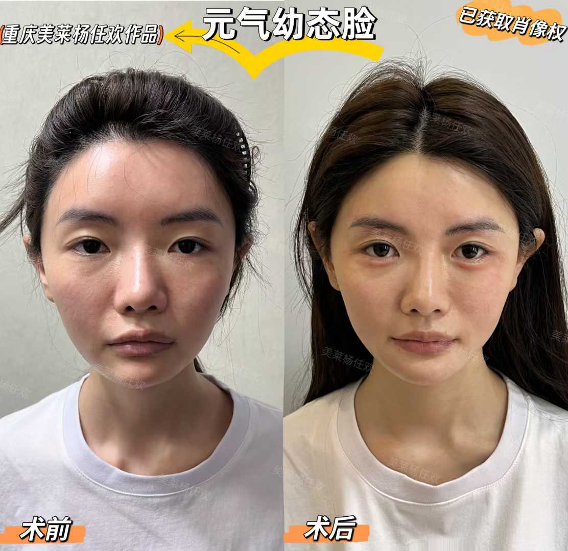 金洪堯醫(yī)生抽脂的服務(wù)特色