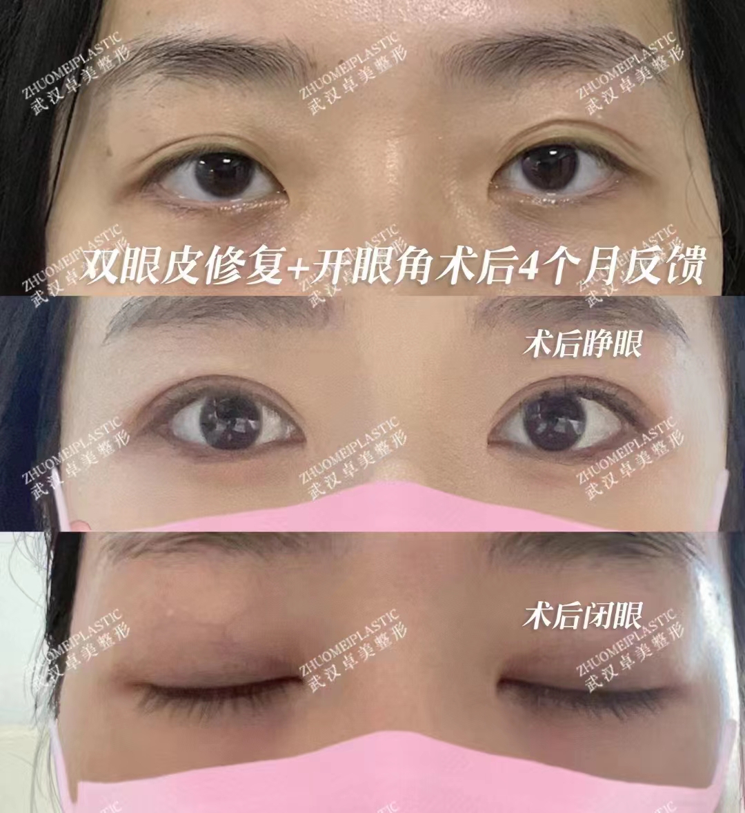 金洪堯醫(yī)生預(yù)約詢問方式