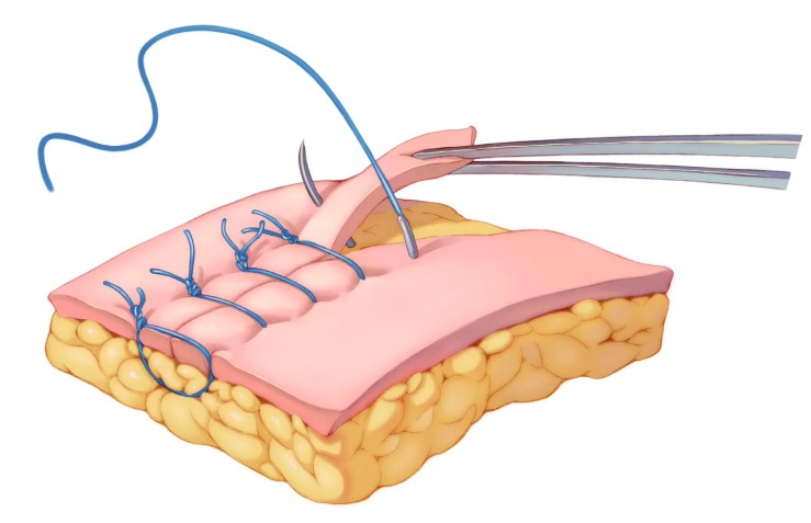 二、劉俊醫(yī)生：強于“高難修復(fù)”精致華麗m.sorencai.cn