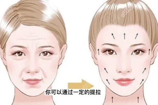 24h在線預(yù)約杜太超醫(yī)生！拉皮3萬起無翻車，技術(shù)精細(xì)、個性化設(shè)計(jì)術(shù)后關(guān)懷