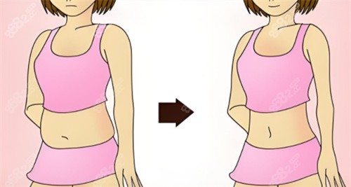 吸脂前與吸脂后對比素材圖