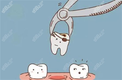 拔牙卡通圖展示