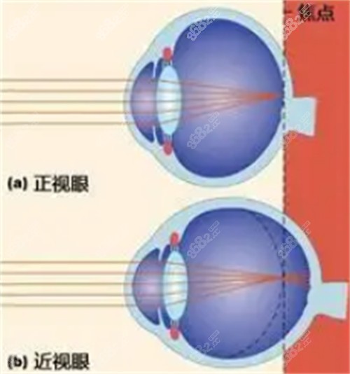 長沙宏朗眼科正不正規(guī)？正規(guī)眼科|深度解析其手術(shù)設(shè)備、服務(wù)質(zhì)量與患者反