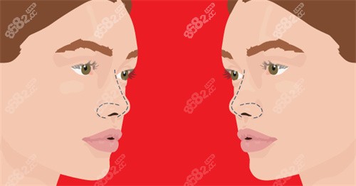 鼻部形態(tài)示意圖