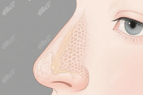 徐永豐醫(yī)生隆鼻成效好嗎？徐永豐2026鼻尖塑形技術(shù)特色及術(shù)后真實(shí)反饋