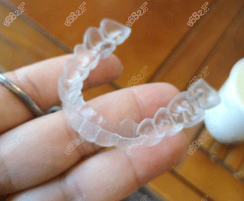 隱形牙齒矯正牙套圖