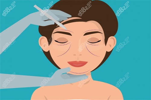 面部提升卡通圖