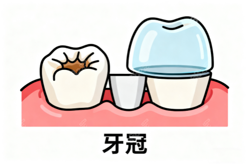 牙冠卡通圖片展示