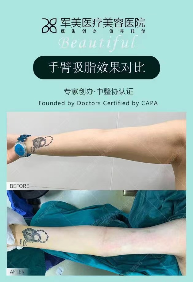 蘇州美 + 萊美容醫(yī)院:5 a級機(jī)構(gòu)經(jīng)驗(yàn)多