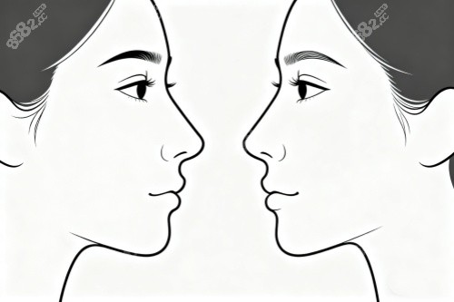 好看鼻型卡通展示圖