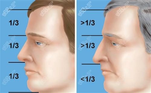 過長的鼻子和正常鼻子矯正對比