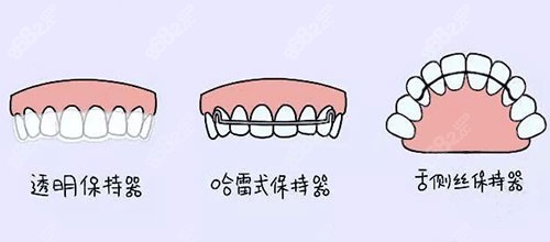 牙齒矯正正畸保持器漫畫圖