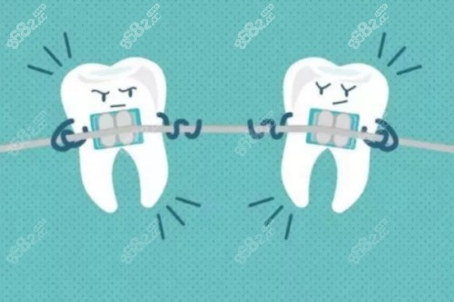 牙齒矯正卡通圖