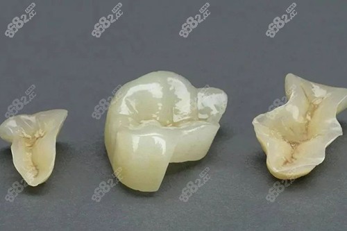 補(bǔ)牙部分實(shí)物