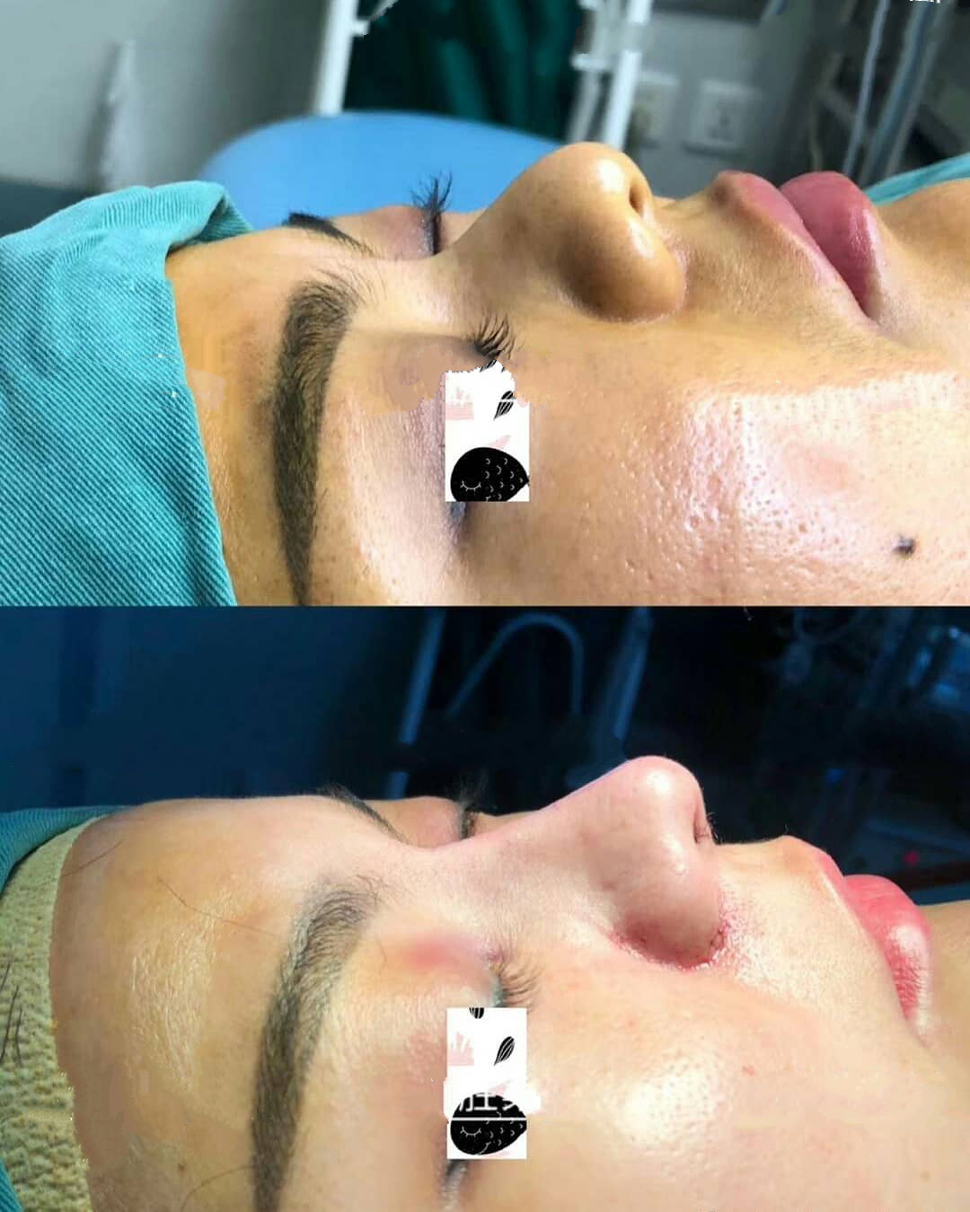 荔灣區(qū)：區(qū)域特色的微拉美手術(shù)