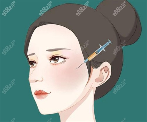 面部注射動畫圖片 面部注射動畫圖片