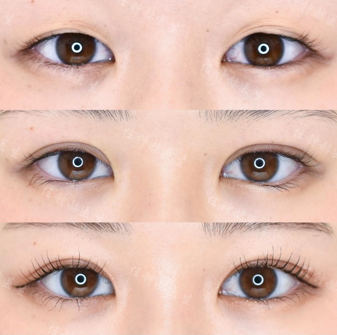 五、上海眼修復(fù)張楚坐診醫(yī)院與團(tuán)隊環(huán)境m.sorencai.cn