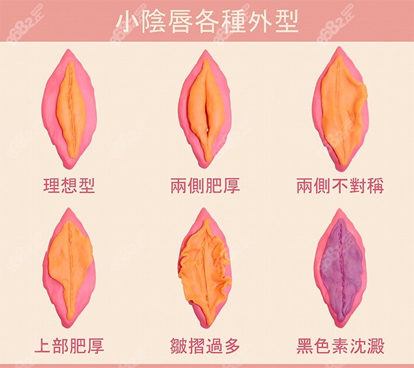 不同女性私密陰唇照片