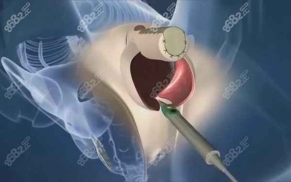 免費(fèi)預(yù)約：開啟變性手術(shù)便捷通道