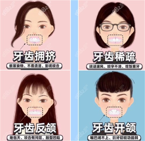 牙齒矯正自查表