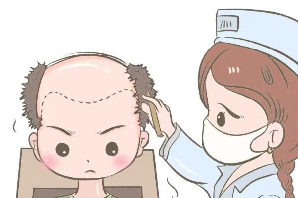 紹興金柯橋植發(fā)在哪？熬夜脫發(fā)星人親測(cè)，這份位置攻略+避坑指南請(qǐng)收好