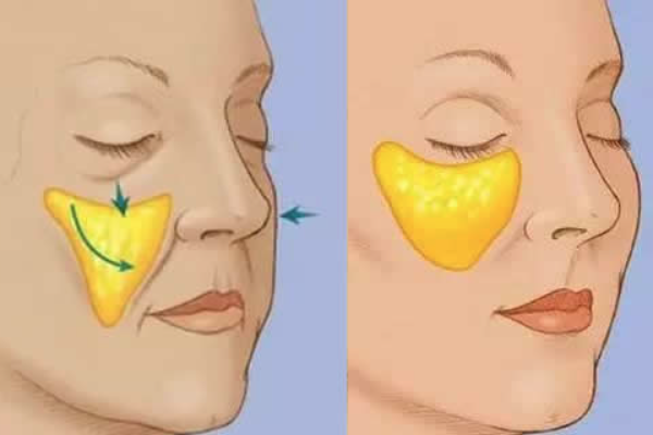 上海華美醫(yī)療美容醫(yī)院是三甲嗎？未定級正規(guī)私立，持四級整形手術(shù)資質(zhì)