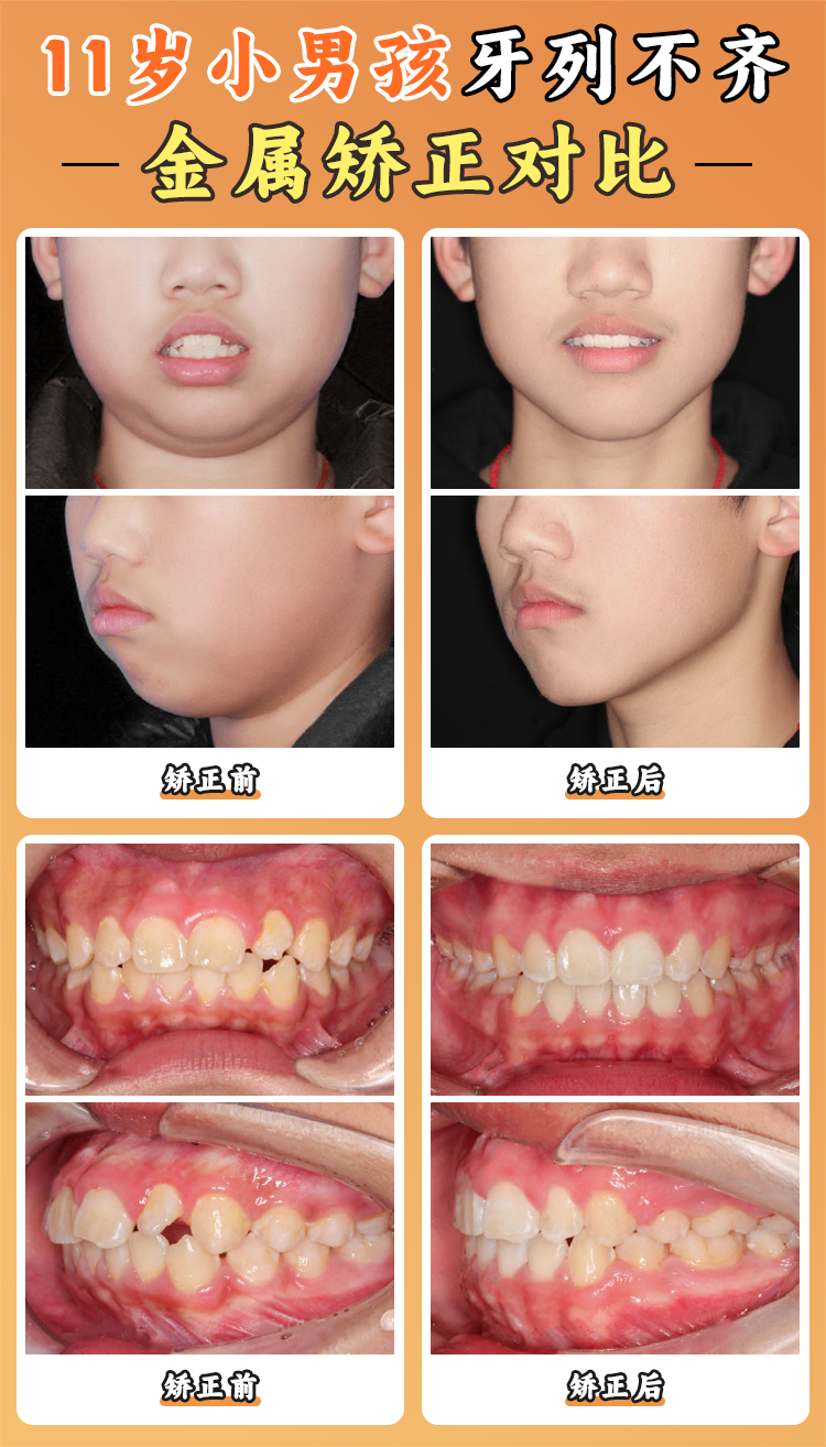 云朵口腔收費(fèi)價(jià)目表揭秘，含正畸項(xiàng)目?jī)r(jià)格詳情