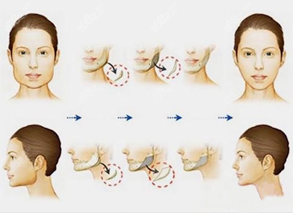 湖南正規(guī)醫(yī)美排名前十
