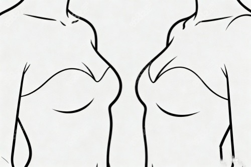 胸部整形卡通圖