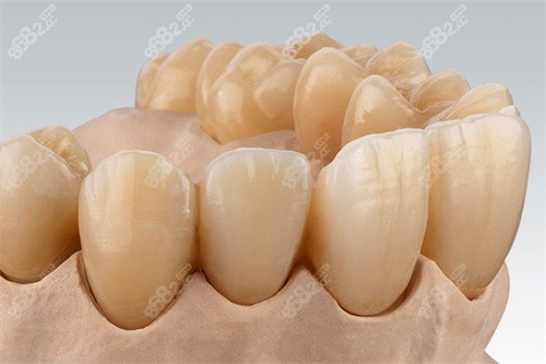 德國(guó)吉爾巴赫全瓷牙怎么樣？能使用多久？ 2026吉爾巴赫硬度、色澤及壽命