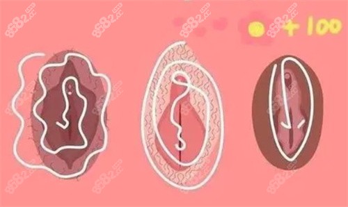 私密漂紅卡通圖