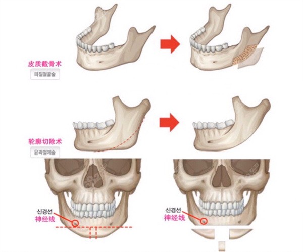 湖南正規(guī)醫(yī)美排名前十