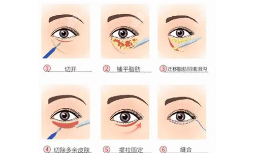 2026重慶眼部整形價格表全公開：眼綜合8000起，眼修復35000左右明細