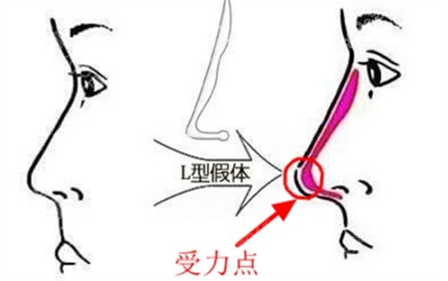 徐永豐隆鼻屬于上海什么水平？水平的高醫(yī)生|病例多/審美超前且預(yù)約火爆