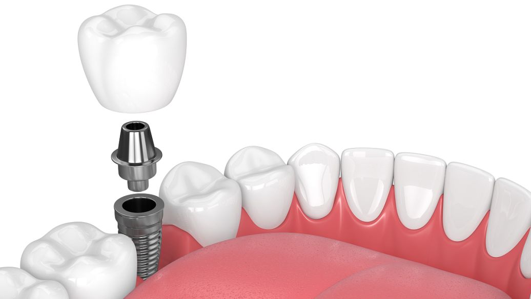孝感整形醫(yī)院排名更新，華美天妃領(lǐng)銜前五，眼鼻項(xiàng)目低至3580元起！