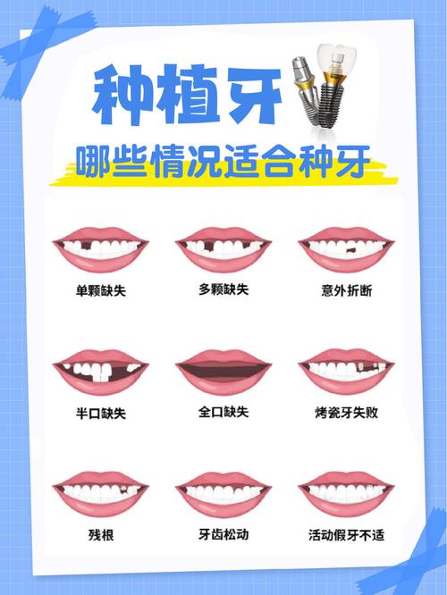 上海盧建3D下巴價格三種檔次如何選擇