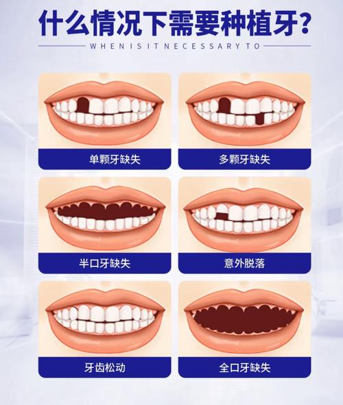 孝感整形醫(yī)院排名更新——孝感中 心醫(yī)院植發(fā)