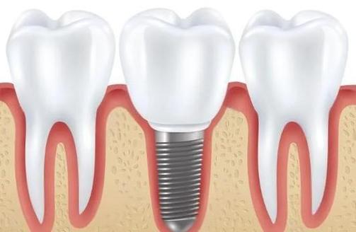 孝感整形醫(yī)院排名更新——孝感市第一人民醫(yī)院