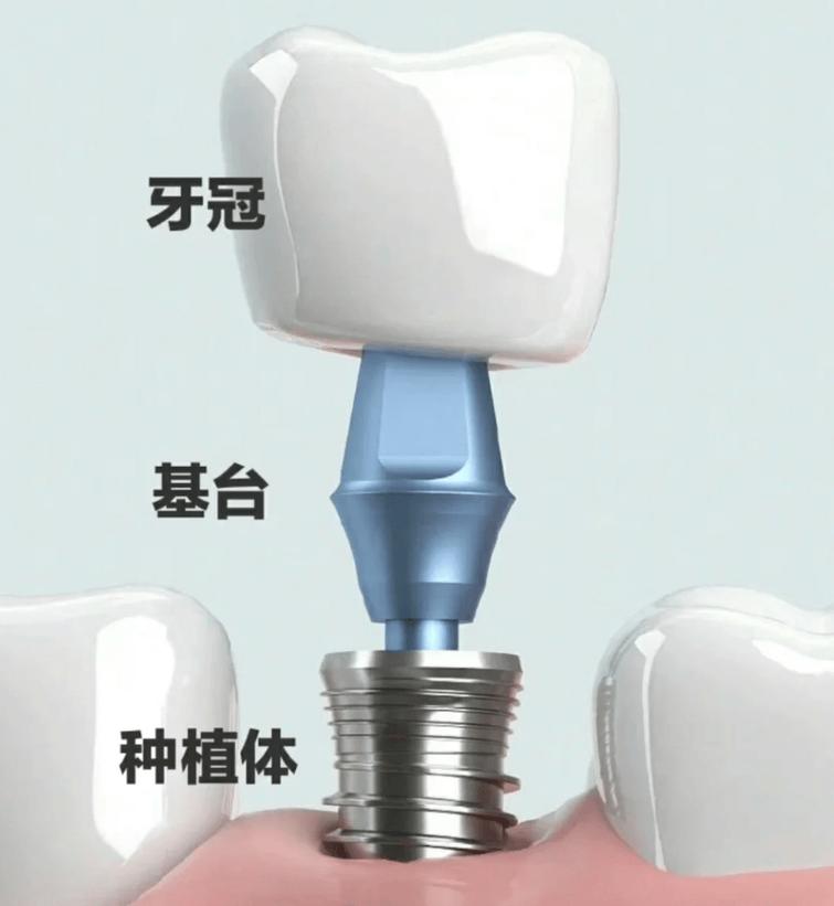 孝感整形醫(yī)院排名更新——孝感韓美植發(fā)