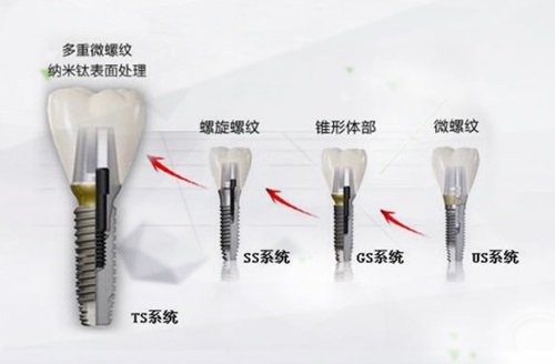 包頭幸福口腔醫(yī)生介紹：8位經(jīng)驗超10年醫(yī)師，多領域專長打造優(yōu)質口腔診療服務 