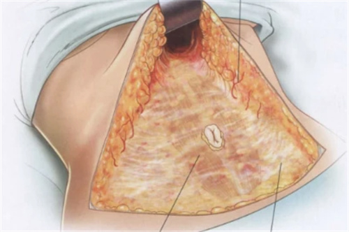 

上海腹壁整形手術(shù)好的醫(yī)院排名匯總，時光華美伯思立等醫(yī)院實力大揭秘，附醫(yī)生技術(shù)優(yōu)勢及整形手術(shù)價格參考表