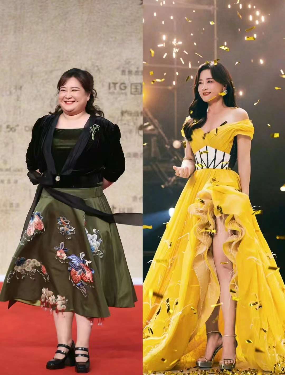 承德玥萊美抽脂的優(yōu)勢(shì)