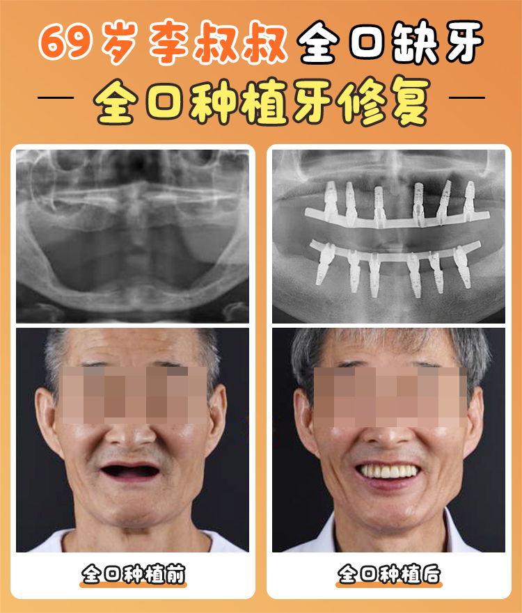 二、深圳麥芽口腔