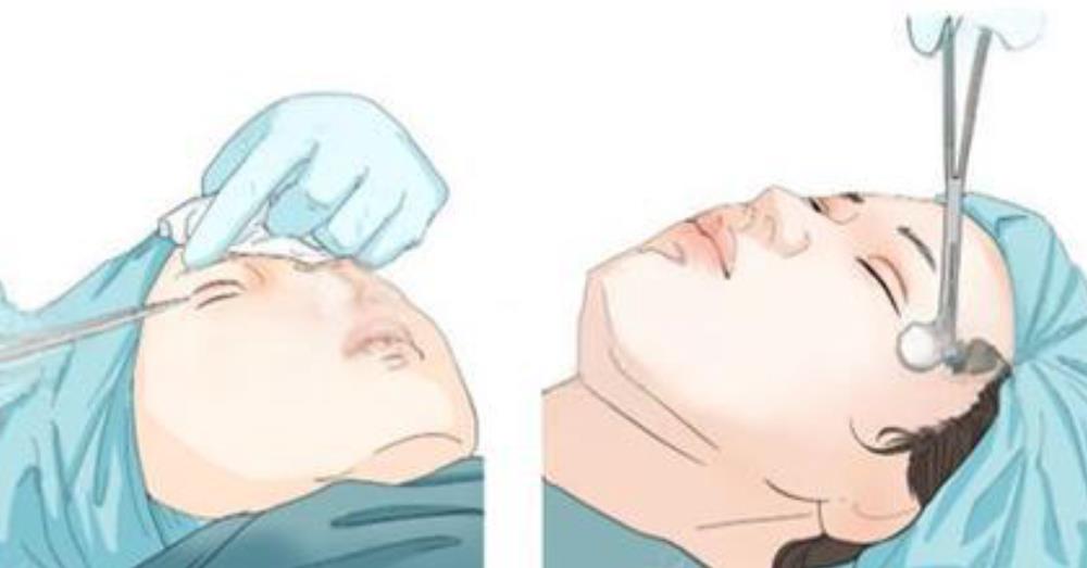 寫(xiě)在末尾：成都米蘭柏羽盧尚兵 vs 高亮醫(yī)生，誰(shuí)更適合你？